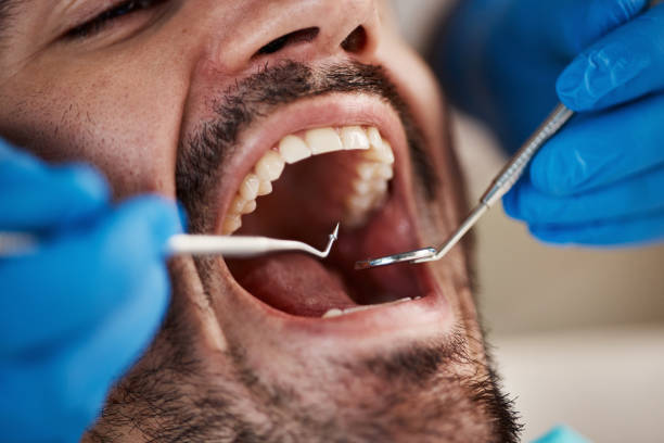 Best Walk-In Emergency Dentist in Attica, MI
