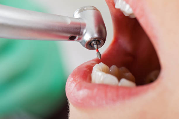 Best Pediatric Emergency Dentist in Attica, MI